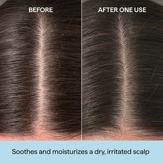 Scalp Revival Rosemary Pre Wash Oil