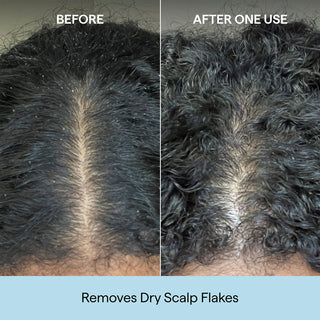 Scalp Revival Charcoal + Coconut Oil Micro Exfoliating Shampoo
