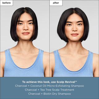 Scalp Revival Charcoal + Biotin Dry Shampoo